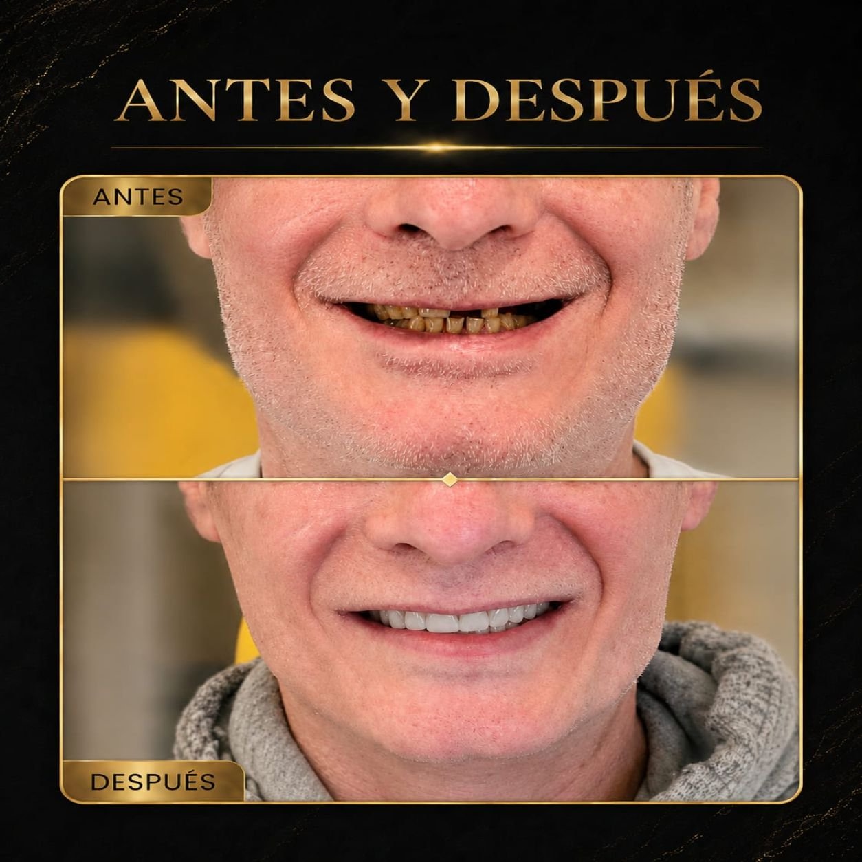 Resultado del tratamiento 1