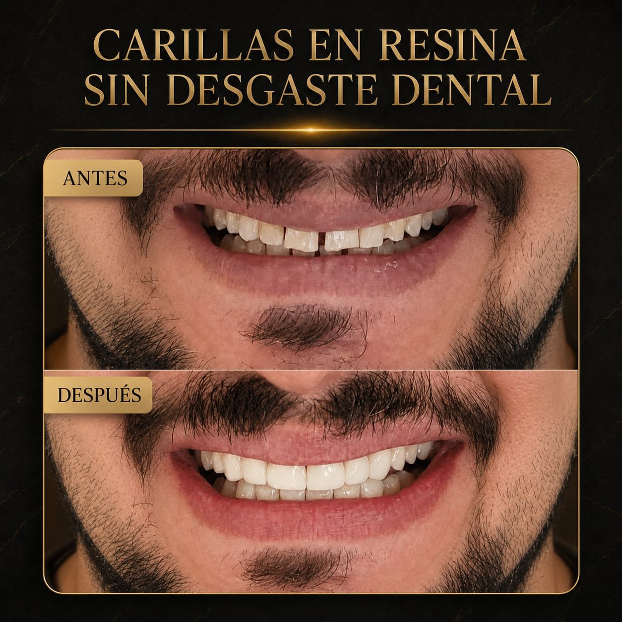 Resultado del tratamiento 3