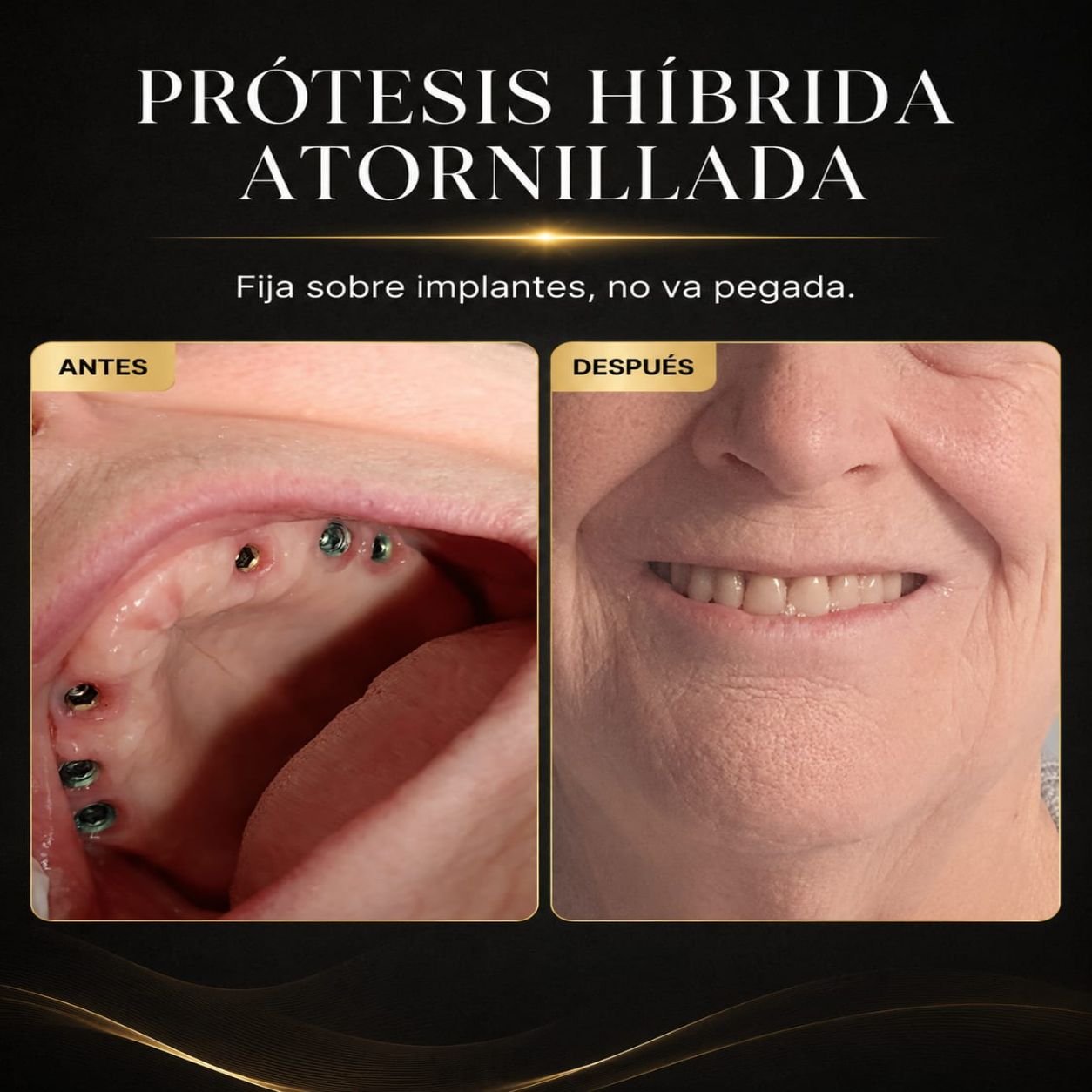 Resultado del tratamiento 4