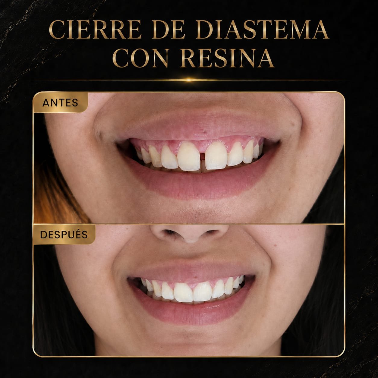 Resultado del tratamiento 5