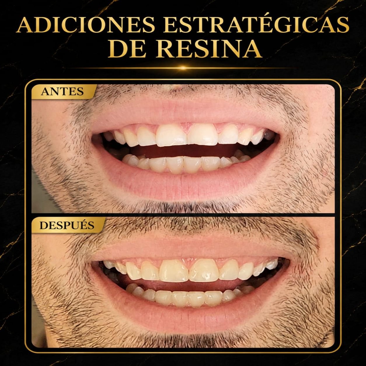 Resultado del tratamiento 6