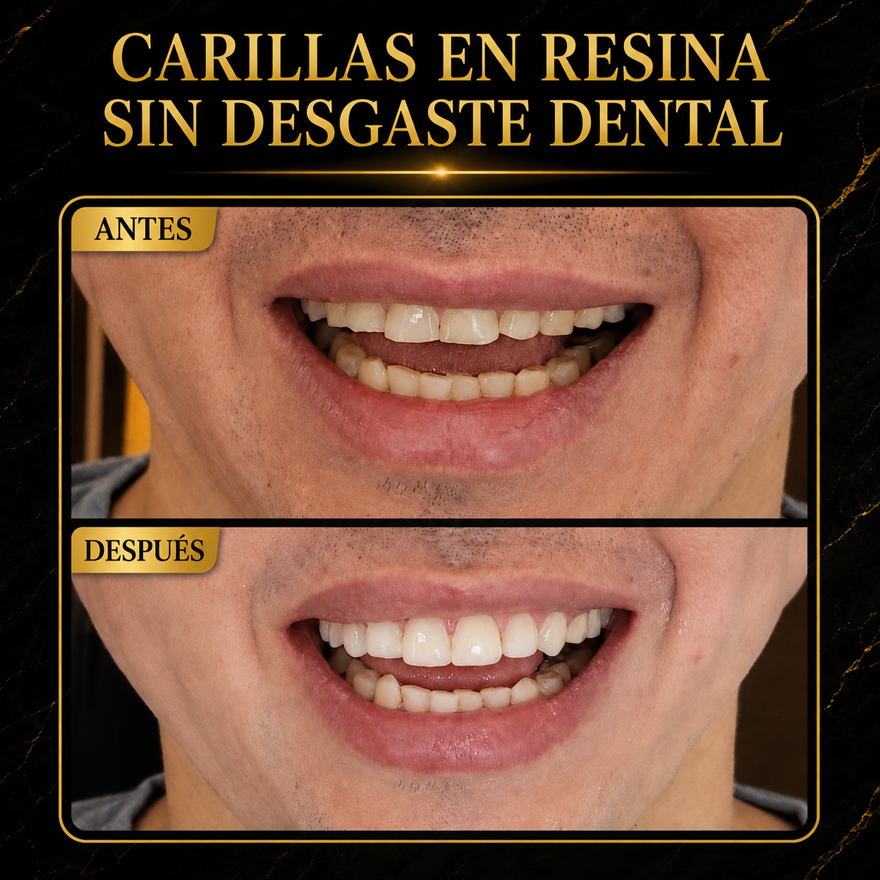 Resultado del tratamiento 7